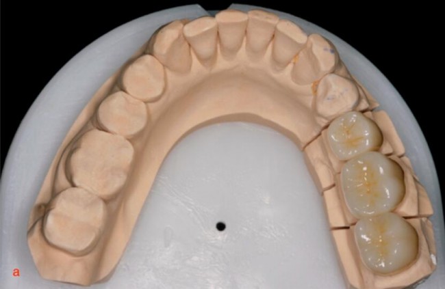 陶瓷3D打印是牙科产品迈出的一步